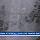 Image for article titled Woman Swallows 2.4-Carat Diamond Engagement Ring in Her Sleep